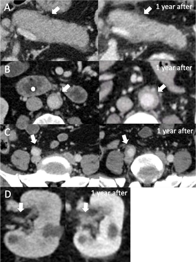 https://cdn.ncbi.nlm.nih.gov/pmc/blobs/9f09/12365821/c69f020d6499/gr2.jpg