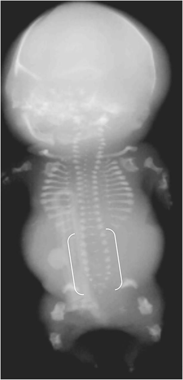 https://cdn.ncbi.nlm.nih.gov/pmc/blobs/9f09/6313373/8e8226b218e6/247_2018_4239_Fig19_HTML.jpg