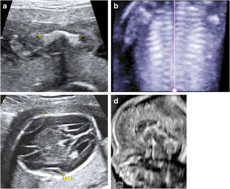 https://cdn.ncbi.nlm.nih.gov/pmc/blobs/9f09/6313373/a597245132cb/247_2018_4239_Fig4_HTML.jpg