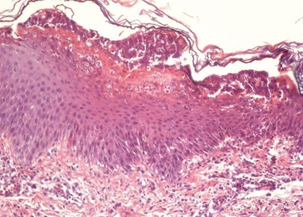 https://cdn.ncbi.nlm.nih.gov/pmc/blobs/9f0e/5871376/17b7d396327b/abd-93-01-0116-g03.jpg