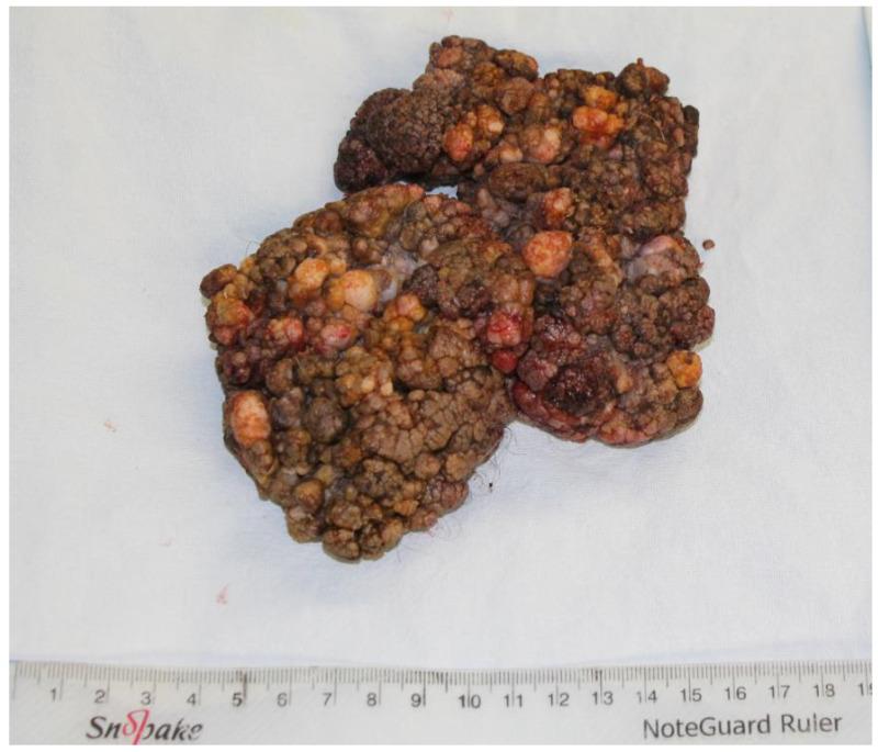 https://cdn.ncbi.nlm.nih.gov/pmc/blobs/9f0f/11355402/4584cd66f050/jpm-14-00887-g002.jpg
