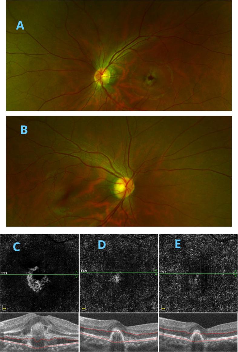 https://cdn.ncbi.nlm.nih.gov/pmc/blobs/9f11/10875827/74cfcfda5515/12886_2024_3344_Fig1_HTML.jpg