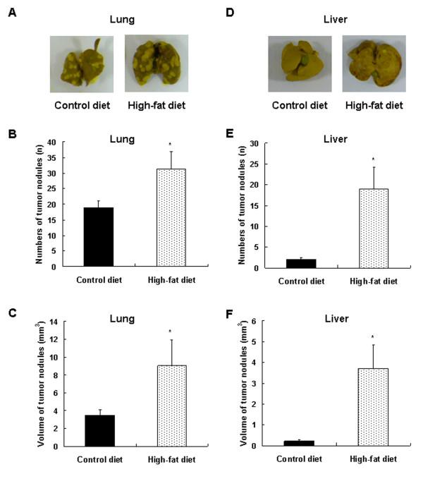 https://cdn.ncbi.nlm.nih.gov/pmc/blobs/9f13/3236342/e78370072b5d/bcr2927-4.jpg
