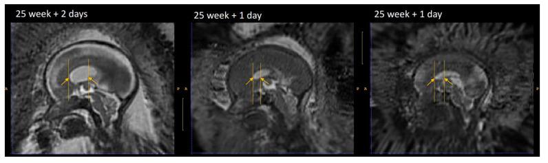 https://cdn.ncbi.nlm.nih.gov/pmc/blobs/9f15/10446400/1f803be0f8fa/openreseurope-1-16291-g0012.jpg