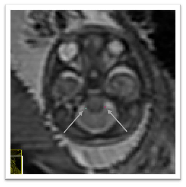 https://cdn.ncbi.nlm.nih.gov/pmc/blobs/9f15/10446400/9a772a7db8a5/openreseurope-1-16291-g0005.jpg