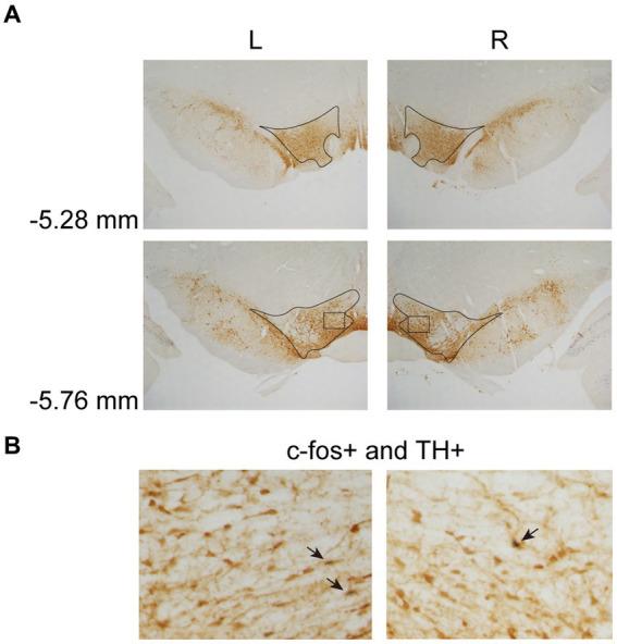 https://cdn.ncbi.nlm.nih.gov/pmc/blobs/9f19/10538645/c6f67dd99c31/fnbeh-17-1252868-g004.jpg