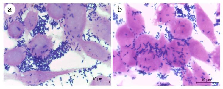 https://cdn.ncbi.nlm.nih.gov/pmc/blobs/9f19/6412307/734c146658c0/nutrients-11-00448-g003.jpg