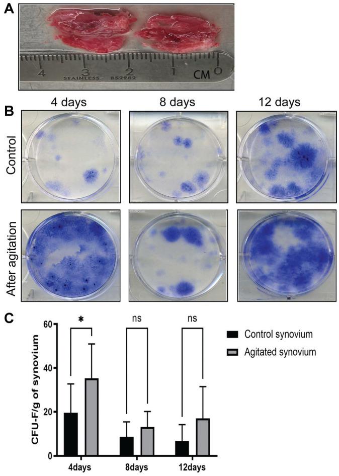 https://cdn.ncbi.nlm.nih.gov/pmc/blobs/9f1f/8739599/299af1e55738/10.1177_03635465211055164-fig4.jpg