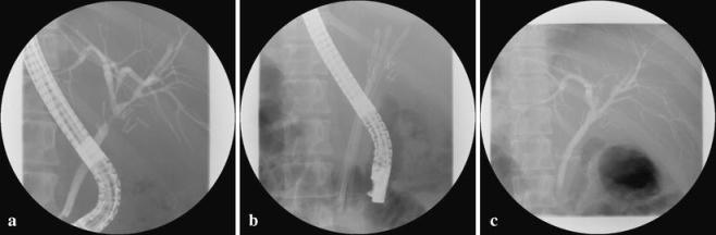 https://cdn.ncbi.nlm.nih.gov/pmc/blobs/9f23/1915638/72aacd3eb7c3/11605_2007_87_Fig2_HTML.jpg