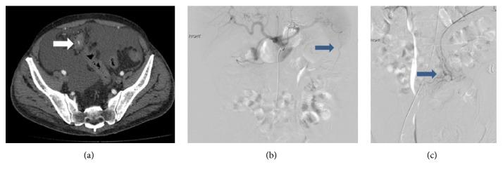 https://cdn.ncbi.nlm.nih.gov/pmc/blobs/9f23/6276472/66b4179ab8a7/CRIRA2018-2926143.003.jpg
