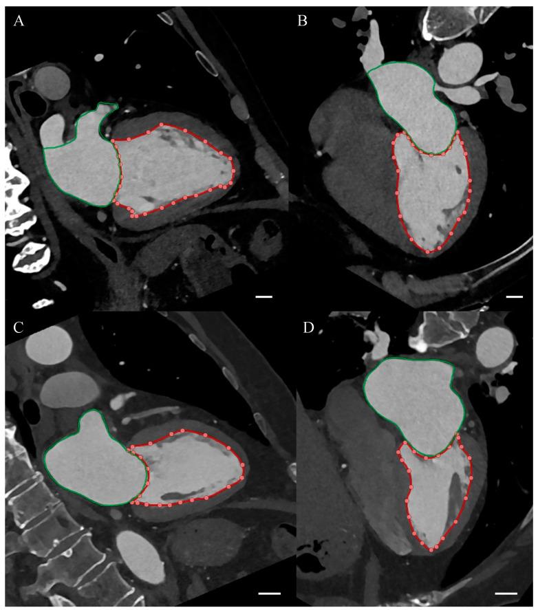 https://cdn.ncbi.nlm.nih.gov/pmc/blobs/9f25/12071540/3233b497ed20/diagnostics-15-01075-g001.jpg