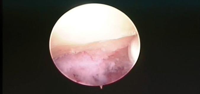 https://cdn.ncbi.nlm.nih.gov/pmc/blobs/9f26/5494200/8f51f38552ca/jced-9-e312-g003.jpg
