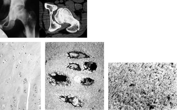 https://cdn.ncbi.nlm.nih.gov/pmc/blobs/9f28/2876835/8b52a436562b/ORT-1745-3674-81-331-g002.jpg
