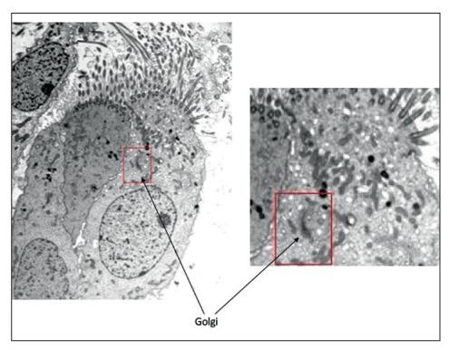 https://cdn.ncbi.nlm.nih.gov/pmc/blobs/9f28/7569661/9f445a0c1f79/ACTA-91-373-g002.jpg
