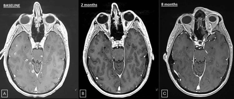 https://cdn.ncbi.nlm.nih.gov/pmc/blobs/9f29/12303361/945cff17ceb3/cureus-0017-00000086925-i01.jpg