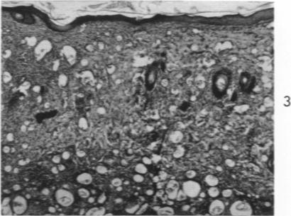 https://cdn.ncbi.nlm.nih.gov/pmc/blobs/9f29/1942410/24aa5c9d0d6a/amjpathol00335-0062-c.jpg