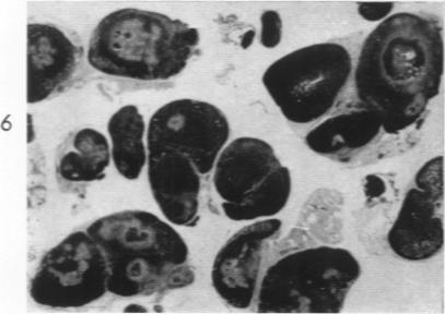 https://cdn.ncbi.nlm.nih.gov/pmc/blobs/9f29/1942410/3acbef7cd66d/amjpathol00335-0062-f.jpg