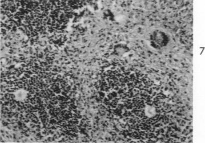 https://cdn.ncbi.nlm.nih.gov/pmc/blobs/9f29/1942410/e6c504c9a571/amjpathol00335-0062-g.jpg