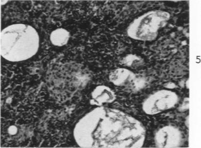 https://cdn.ncbi.nlm.nih.gov/pmc/blobs/9f29/1942410/ed7241f72710/amjpathol00335-0062-e.jpg
