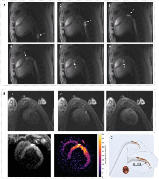 https://cdn.ncbi.nlm.nih.gov/pmc/blobs/9f2a/11615795/70be377f5b07/ADVS-11-2407704-g003.jpg