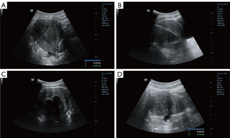 https://cdn.ncbi.nlm.nih.gov/pmc/blobs/9f34/12332589/2e94900388ae/qims-15-08-7382-f3.jpg