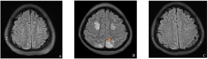 https://cdn.ncbi.nlm.nih.gov/pmc/blobs/9f37/12011752/2751564dd715/fimmu-16-1542973-g001.jpg