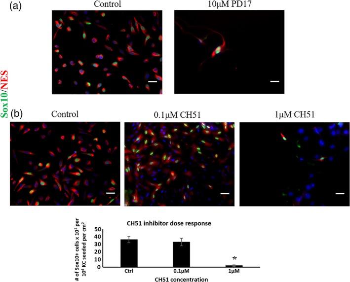 https://cdn.ncbi.nlm.nih.gov/pmc/blobs/9f39/6195909/47968d2b9344/BTM2-3-256-g004.jpg