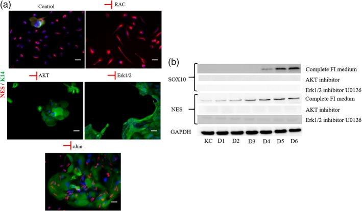 https://cdn.ncbi.nlm.nih.gov/pmc/blobs/9f39/6195909/4f1d4a0f6754/BTM2-3-256-g005.jpg