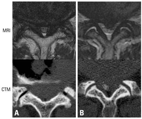 https://cdn.ncbi.nlm.nih.gov/pmc/blobs/9f3c/3017689/fd7835e1b793/ymj-52-137-g005.jpg