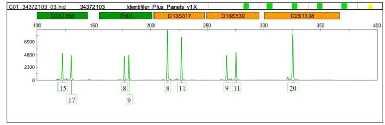 https://cdn.ncbi.nlm.nih.gov/pmc/blobs/9f3c/9711926/c3d51b30ee16/cureus-0014-00000030954-i02.jpg