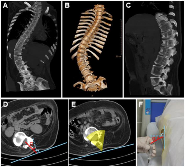 https://cdn.ncbi.nlm.nih.gov/pmc/blobs/9f43/12380810/e58fdbd57b76/fneur-16-1654310-g0001.jpg