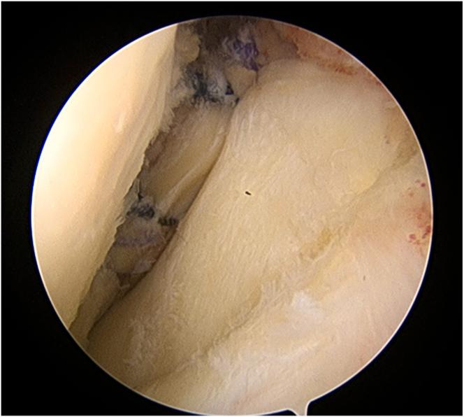 https://cdn.ncbi.nlm.nih.gov/pmc/blobs/9f47/10466424/098185c6f157/gr6.jpg