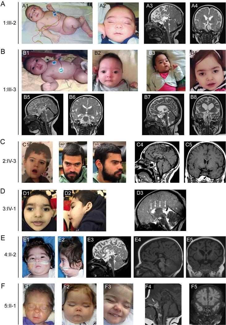 https://cdn.ncbi.nlm.nih.gov/pmc/blobs/9f4b/8351430/aa113c319923/nihms-1721542-f0001.jpg