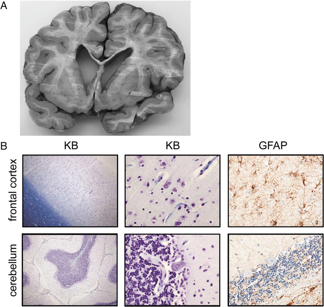 https://cdn.ncbi.nlm.nih.gov/pmc/blobs/9f4b/8351430/c59cd54fef63/nihms-1721542-f0003.jpg