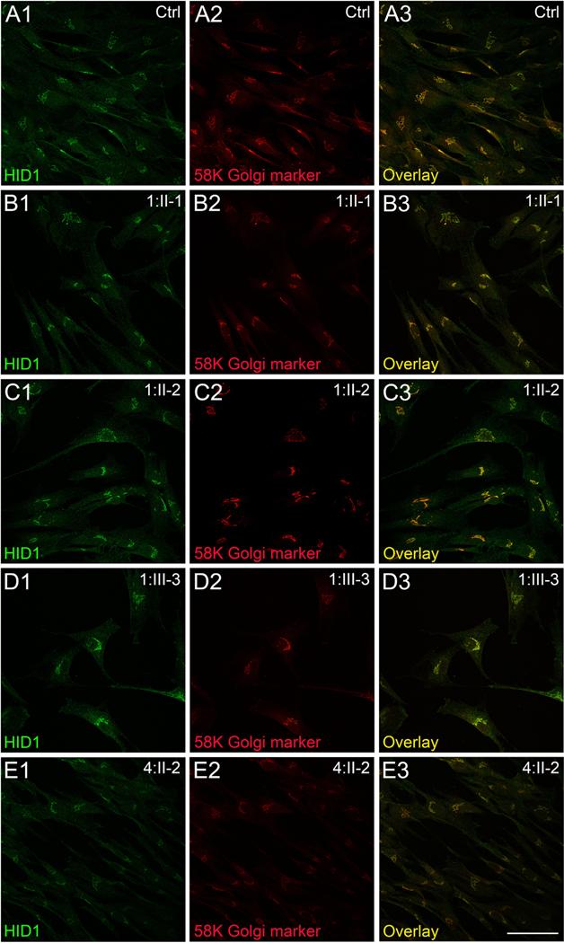 https://cdn.ncbi.nlm.nih.gov/pmc/blobs/9f4b/8351430/e9bee6795d25/nihms-1721542-f0006.jpg