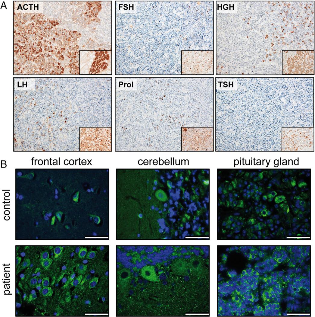 https://cdn.ncbi.nlm.nih.gov/pmc/blobs/9f4b/8351430/eb754a7c0a35/nihms-1721542-f0004.jpg