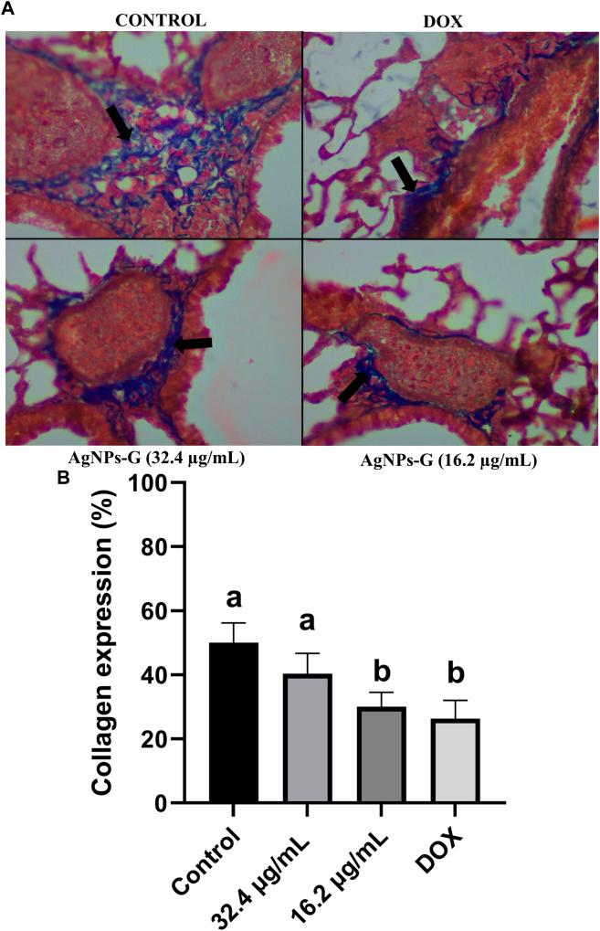 https://cdn.ncbi.nlm.nih.gov/pmc/blobs/9f4e/10851876/286a841b2dd5/fphar-14-1332439-g009.jpg