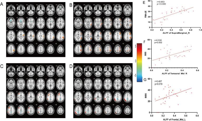 https://cdn.ncbi.nlm.nih.gov/pmc/blobs/9f4f/11471684/a7374bbeaa54/fneur-15-1454220-g004.jpg