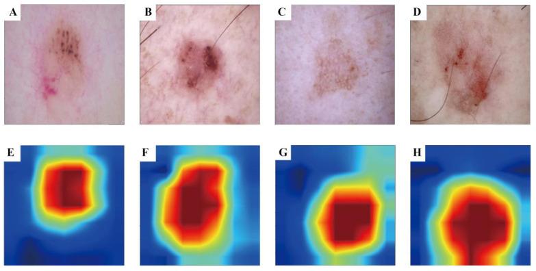 https://cdn.ncbi.nlm.nih.gov/pmc/blobs/9f50/11134443/91cc2ec479c3/jcav15p3350g003.jpg