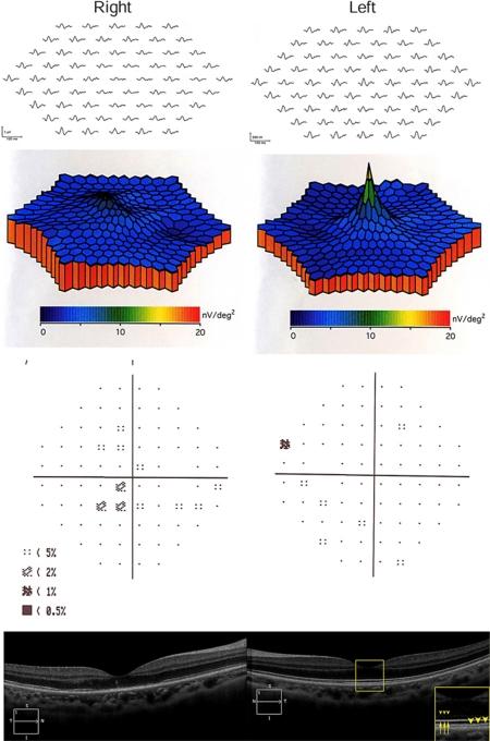 https://cdn.ncbi.nlm.nih.gov/pmc/blobs/9f55/3220907/4d4198071239/cop0002-0307-f01.jpg