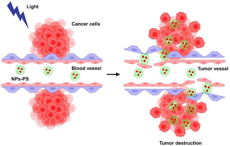 https://cdn.ncbi.nlm.nih.gov/pmc/blobs/9f56/11537162/23363d83dabd/IJN-19-11023-g0004.jpg