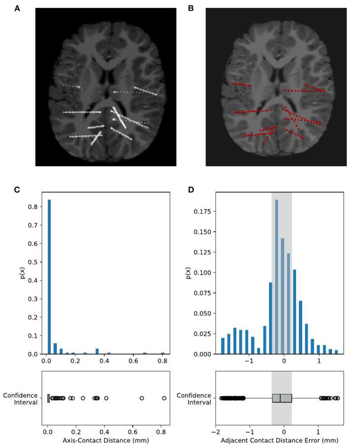 https://cdn.ncbi.nlm.nih.gov/pmc/blobs/9f57/8782204/54b66b067167/fninf-15-773890-g0007.jpg