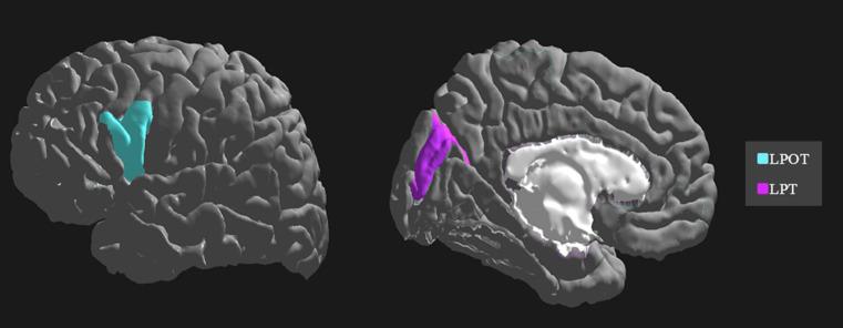 https://cdn.ncbi.nlm.nih.gov/pmc/blobs/9f58/10333052/ece6ac74d47b/fneur-14-1106612-g002.jpg