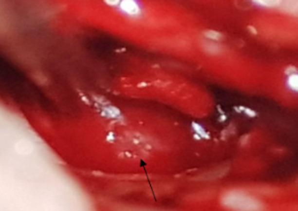 https://cdn.ncbi.nlm.nih.gov/pmc/blobs/9f5a/9941617/41121ff6ac32/PAMJ-43-166-g005.jpg