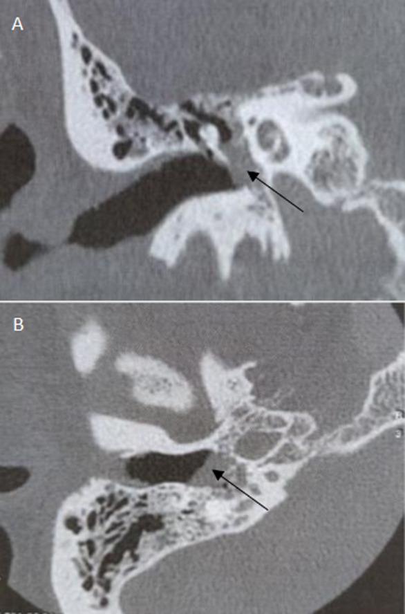 https://cdn.ncbi.nlm.nih.gov/pmc/blobs/9f5a/9941617/b6b47547bcbc/PAMJ-43-166-g002.jpg