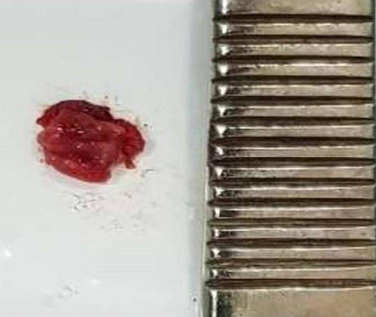 https://cdn.ncbi.nlm.nih.gov/pmc/blobs/9f5a/9941617/f6d31d503451/PAMJ-43-166-g007.jpg
