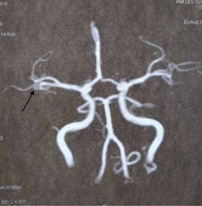 https://cdn.ncbi.nlm.nih.gov/pmc/blobs/9f5a/9941617/f8d63e495810/PAMJ-43-166-g004.jpg
