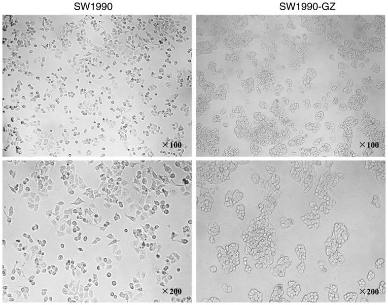 https://cdn.ncbi.nlm.nih.gov/pmc/blobs/9f62/6676397/b4e12b86896f/ol-18-03-3065-g01.jpg