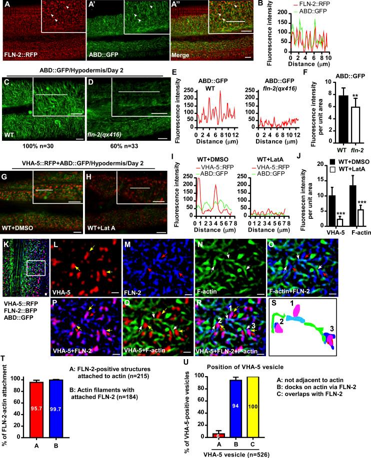 https://cdn.ncbi.nlm.nih.gov/pmc/blobs/9f63/9115679/b4360508644d/JCB_202201020_Fig4.jpg