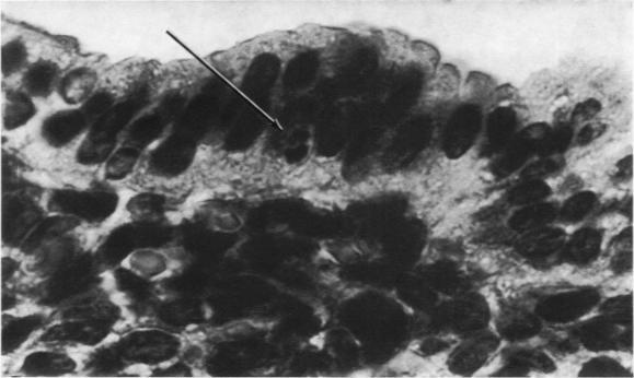 https://cdn.ncbi.nlm.nih.gov/pmc/blobs/9f65/2013359/481372287df7/amjpathol00428-0154-b.jpg